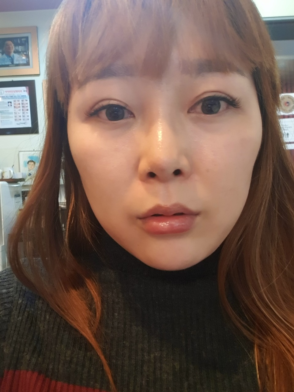 아이라인성형외과의원 위치 · 진료시간 · 후기 확인하기 | 굿닥