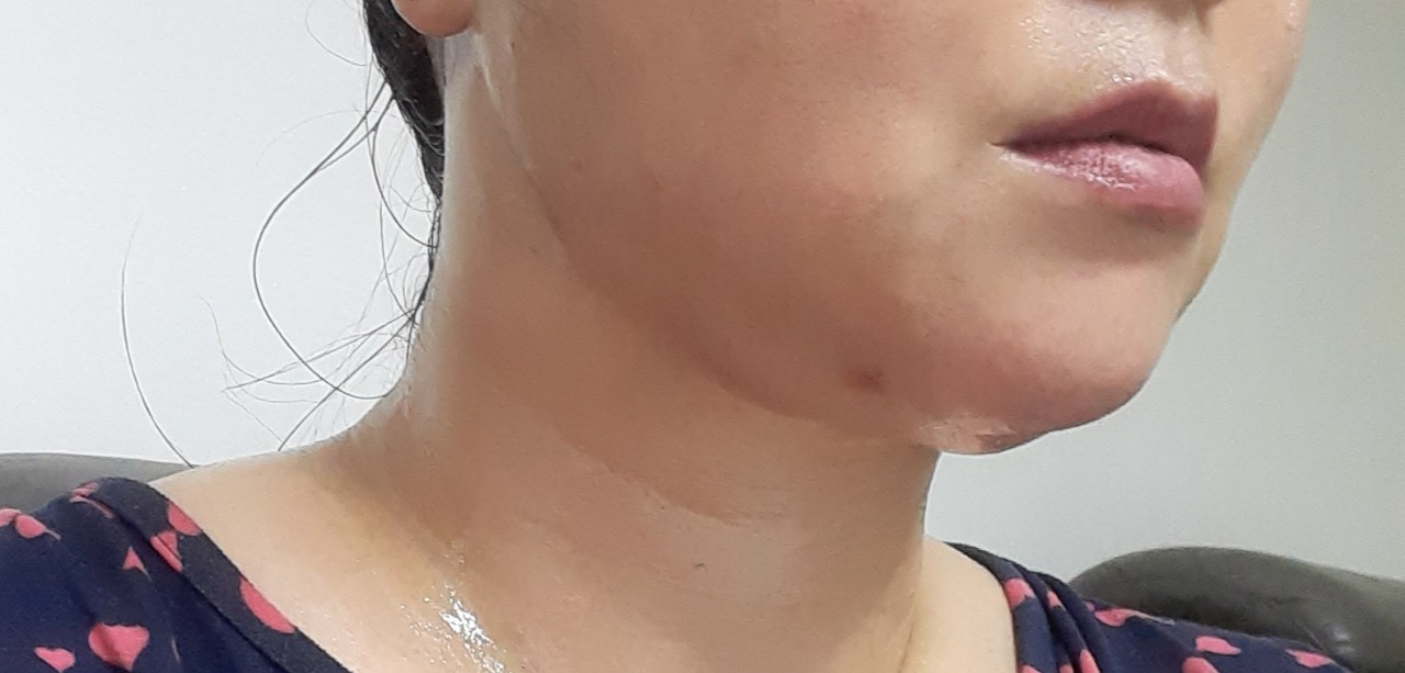 라비앙성형외과의원 위치 · 진료시간 · 후기 확인하기 | 굿닥
