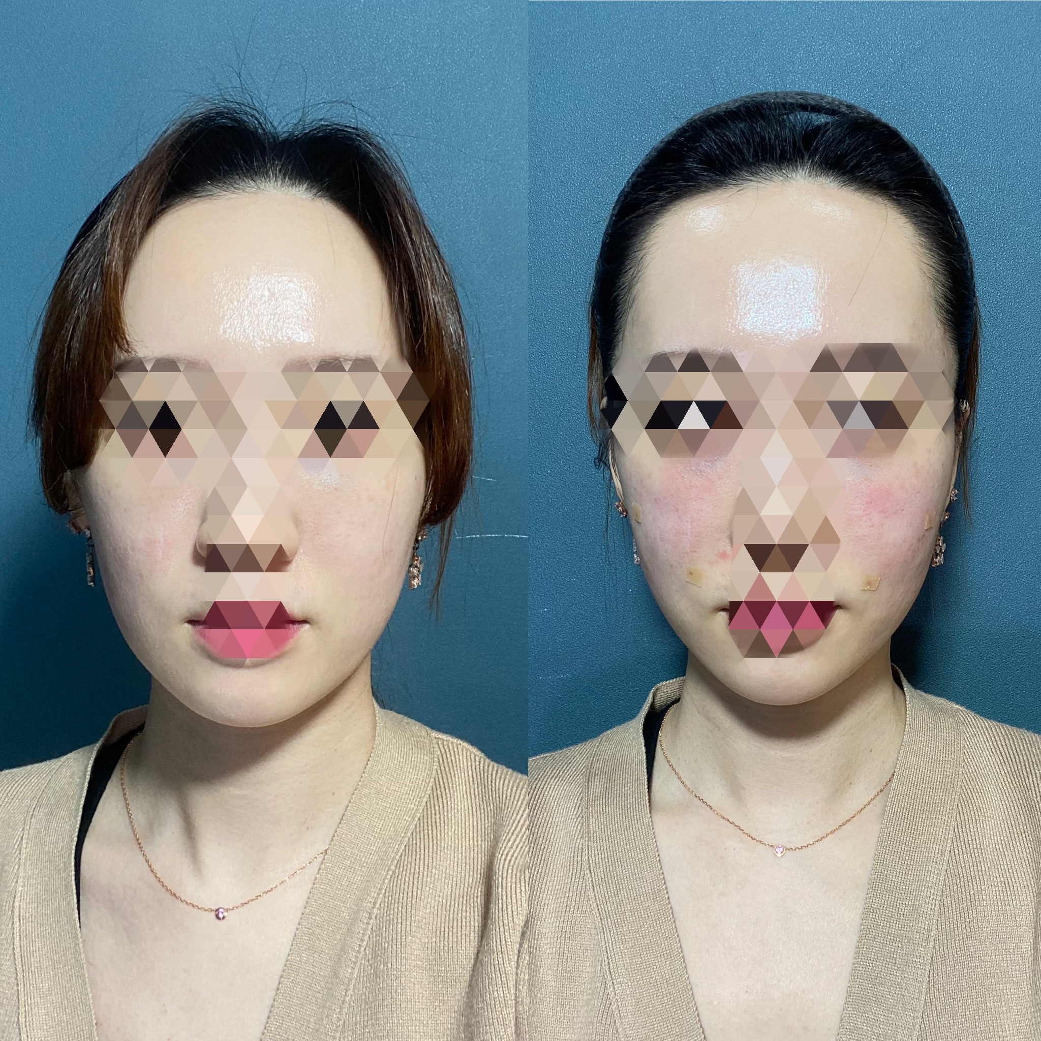 재시아성형외과의원 위치 · 진료시간 · 후기 확인하기 | 굿닥